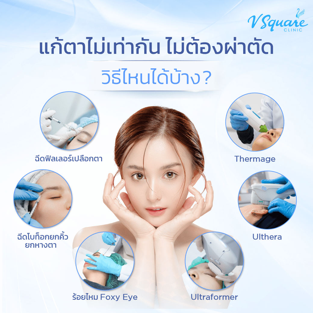 วิธีแก้ตาไม่เท่ากัน