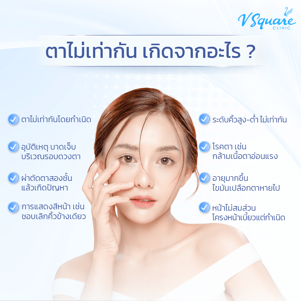 สาเหตุตาไม่เท่ากัน