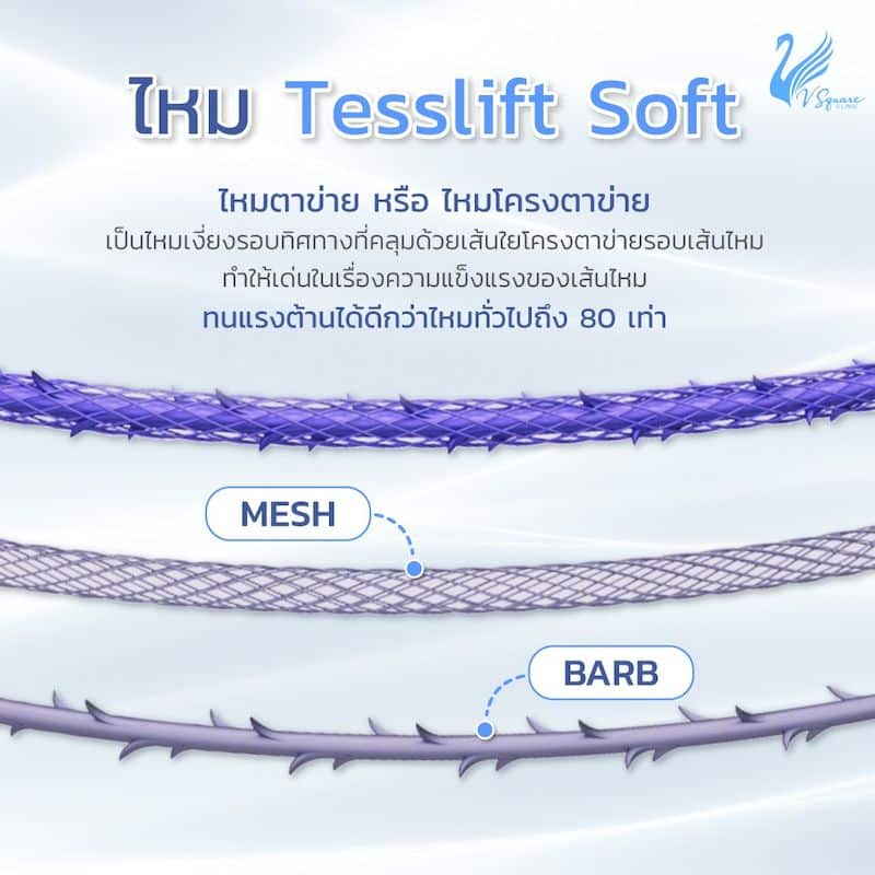 โครงสร้างไหมโครงตาข่าย