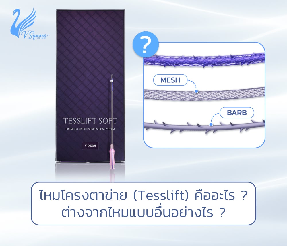 ไหมโครงตาข่าย คืออะไร