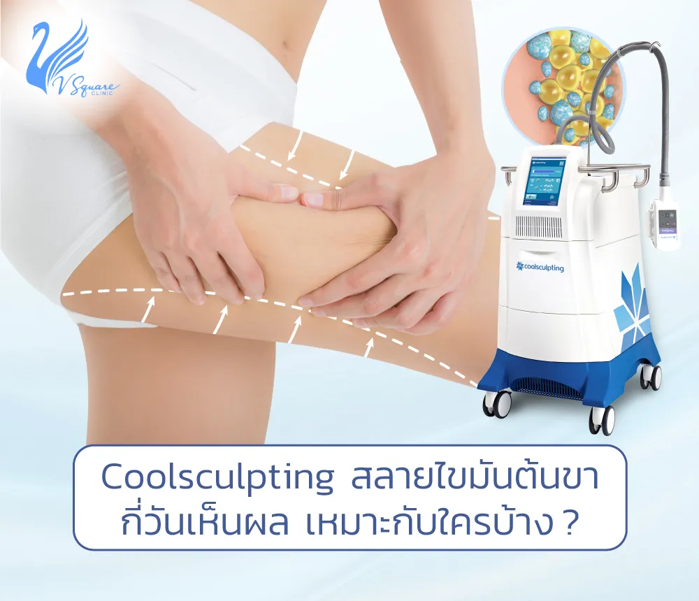 Coolsculpting-สลายไขมันต้นขา1000X860