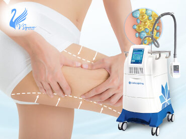 Coolsculpting-สลายไขมันต้นขา370X277