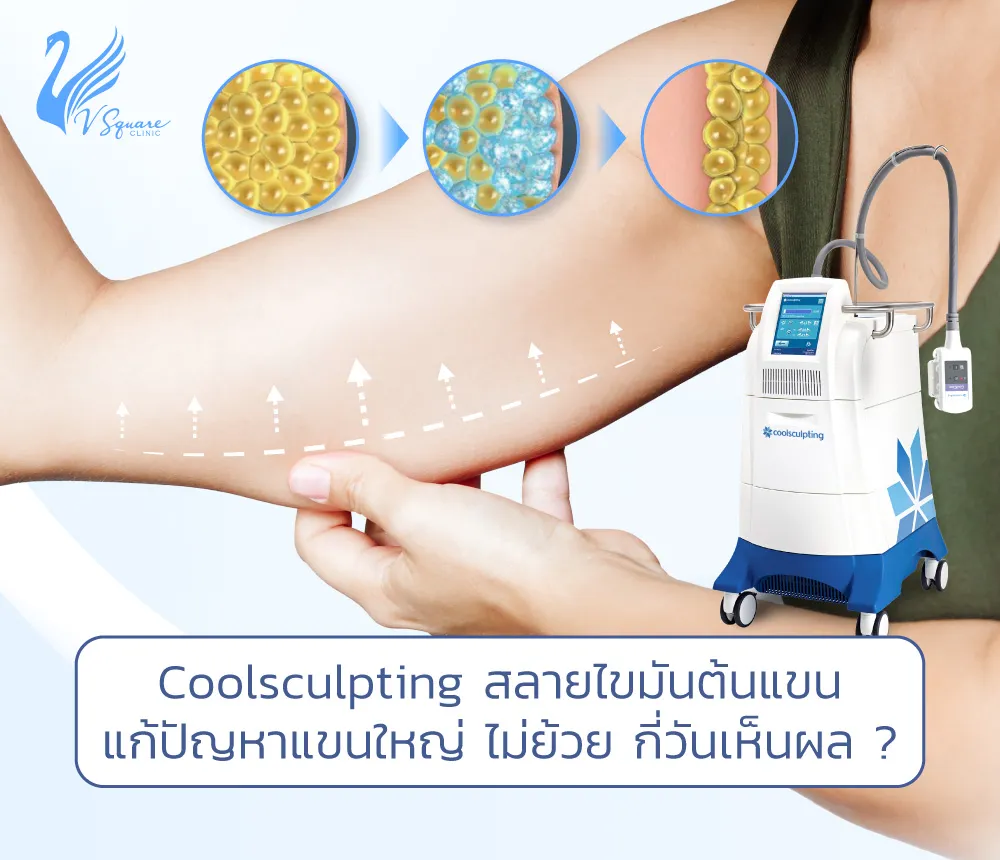 Coolsculpting-สลายไขมันต้นแขน1000x860