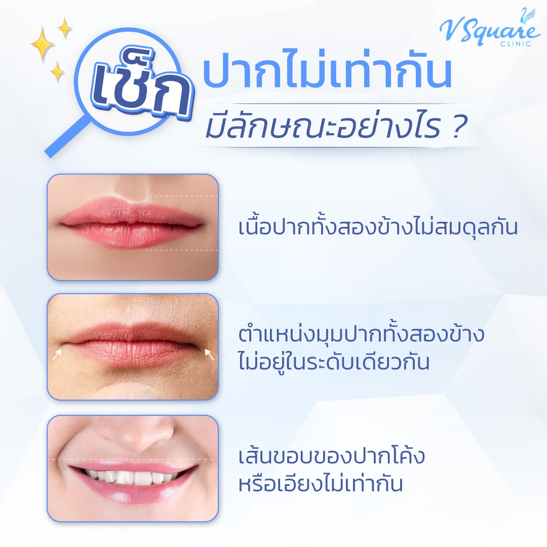 ปากไม่เท่ากัน