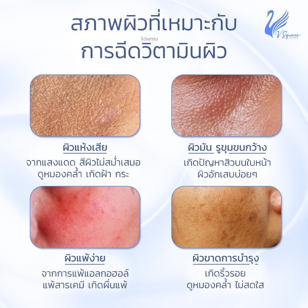 ฉีดวิตามินผิวขาว ทำให้ผิวขาวขึ้นจริงไหม อันตรายหรือไม่ กี่ครั้งถึงเห็นผล ! ฉีดวิตามินผิวขาว ทำให้ผิวขาวขึ้นจริงไหม อันตรายหรือไม่ กี่ครั้งถึงเห็นผล !