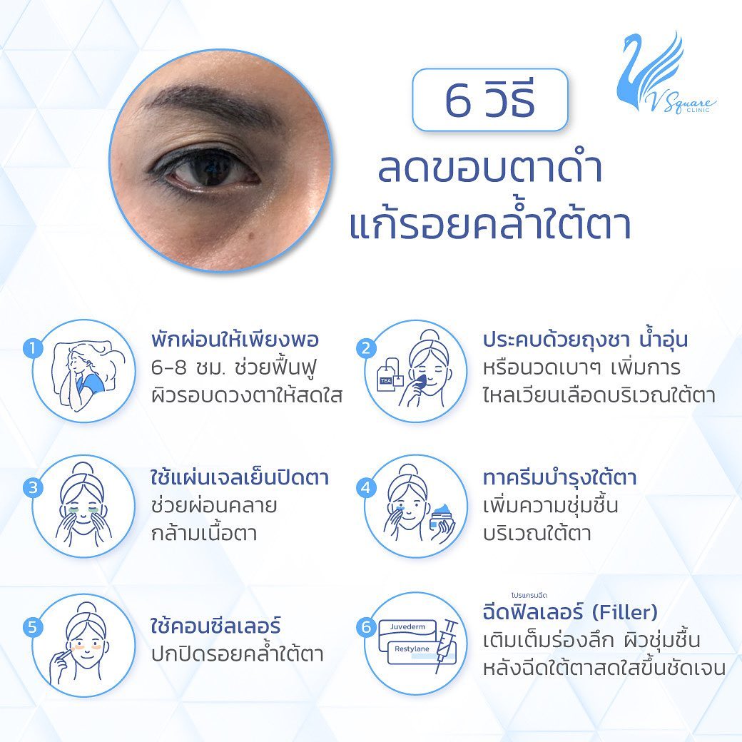 10 วิธี แก้ขอบตาดำคล้ำ เห็นผลเร็ว เร่งเด่วน พร้อมสาเหตุ และวิธีป้องกัน 10 วิธี แก้ขอบตาดำคล้ำ เห็นผลเร็ว เร่งเด่วน พร้อมสาเหตุ และวิธีป้องกัน