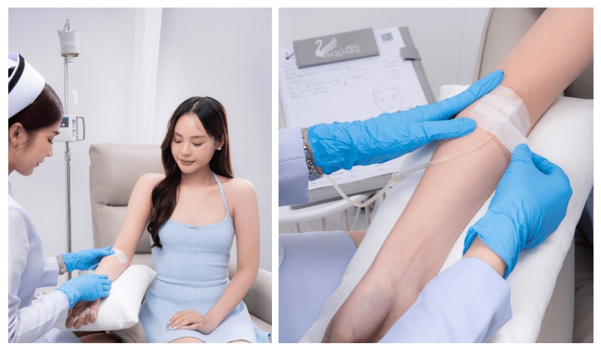 การฉีดวิตามินผิว