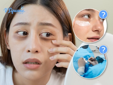 ถุงใต้ตา