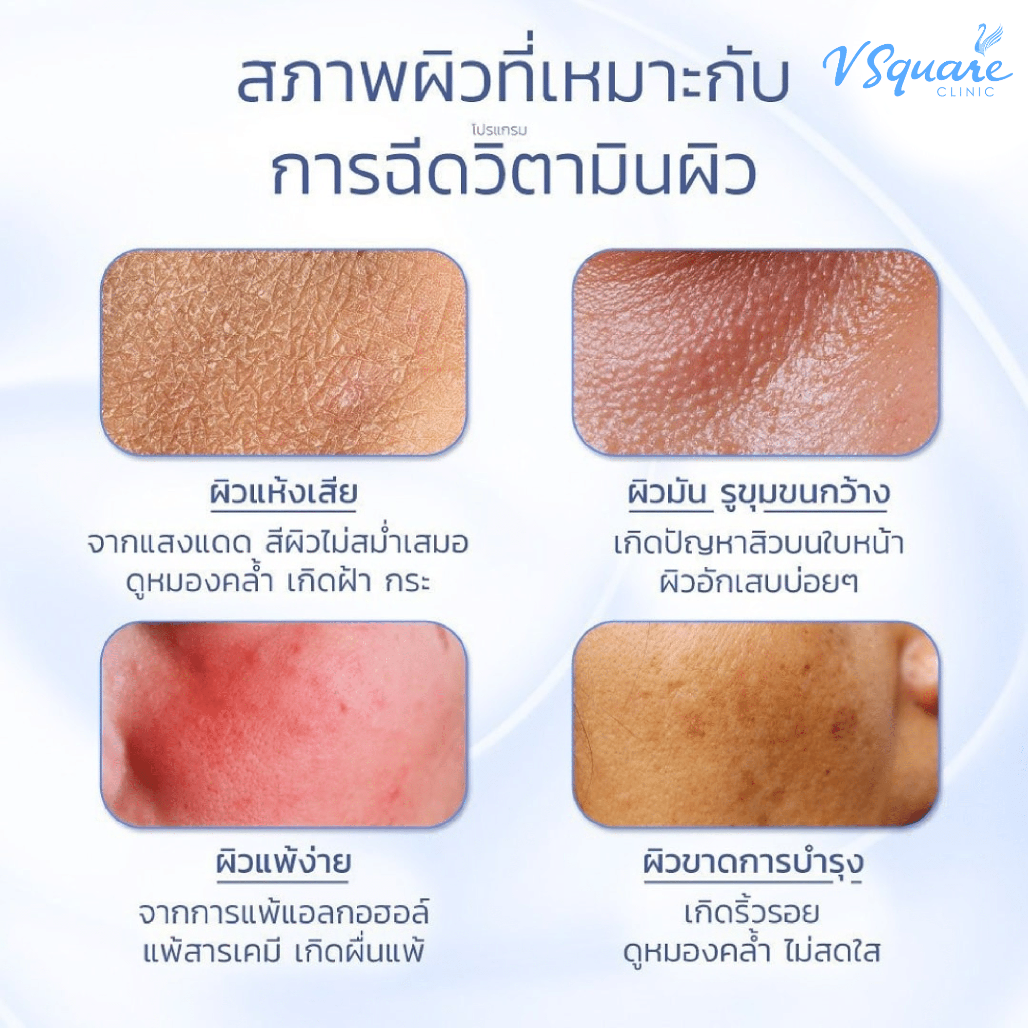 ปัญหาผิวแห้ง ผิวคล้ำ