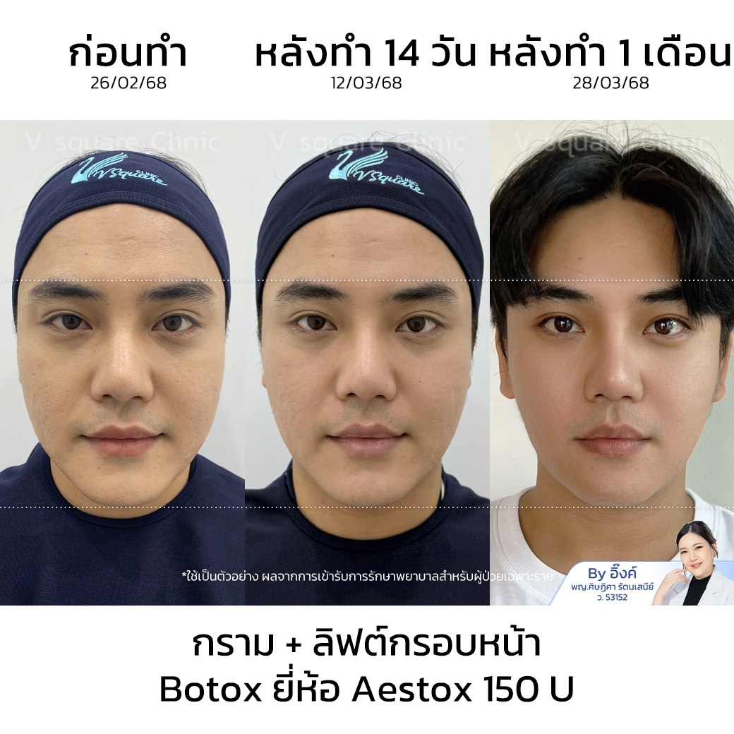 รีวิวโบลดกราม เห็นผล_โย