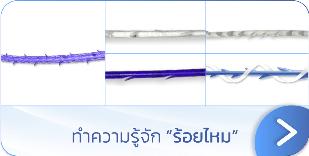 ร้อยไหม คือ