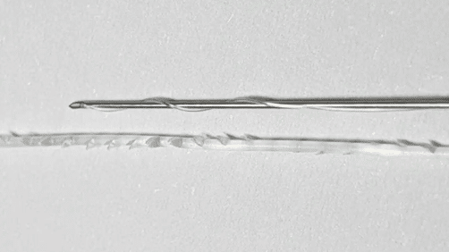 ร้อยไหมคอลลาเจนคืออะไร