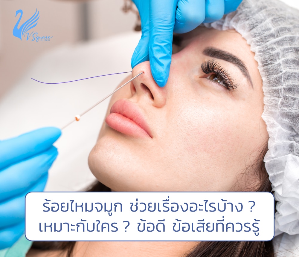 ร้อยไหมจมูกข้อเสีย