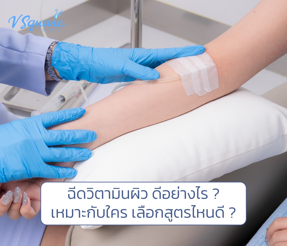 วิตามินผิวขาว