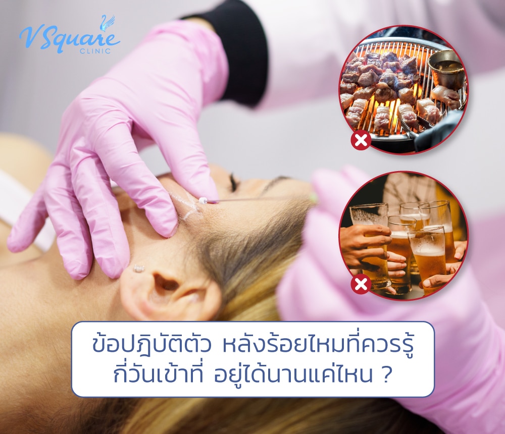 หลังร้อยไหมกี่วันเห็นผล