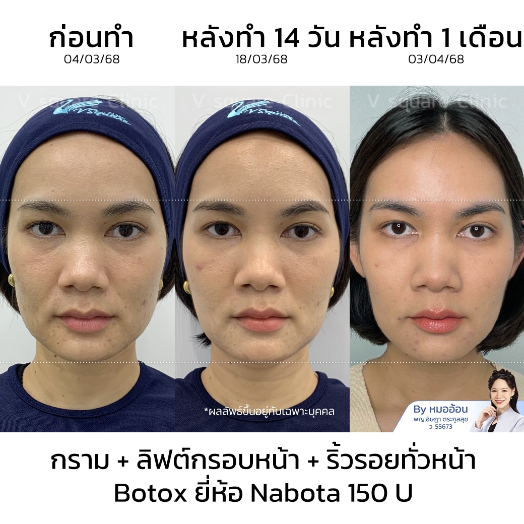 โบท็อกรีวิว_คุณน้ำ