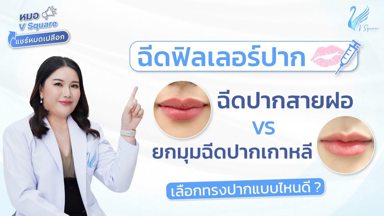 ฉีดฟิลเลอร์ปากทรงไหนดี by หมอแคท