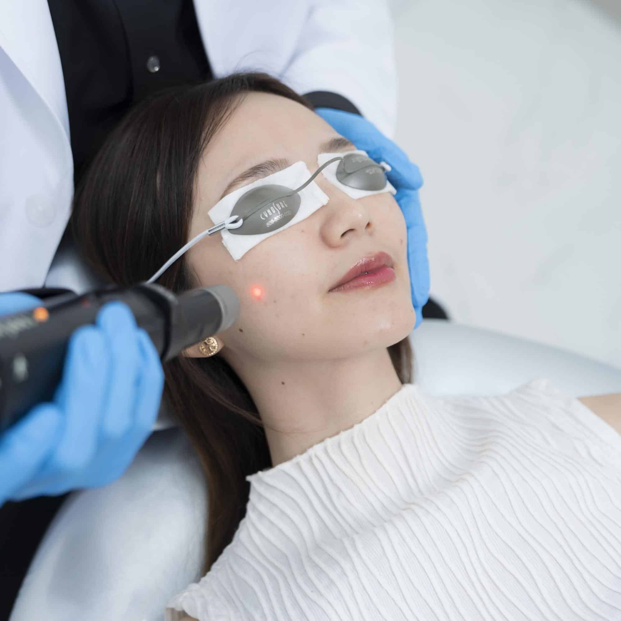 ทำเลเซอร์