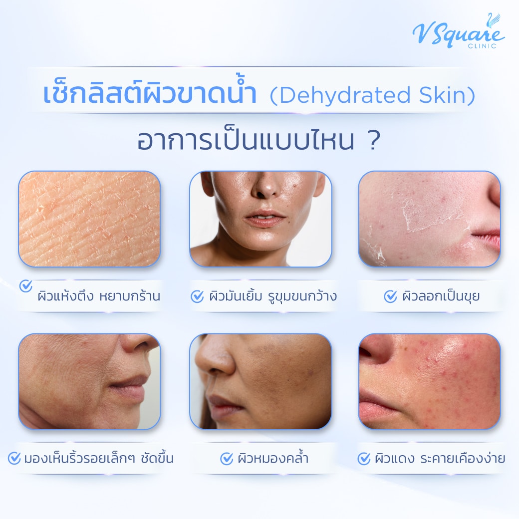 ผิวขาดน้ำ ลักษณะ