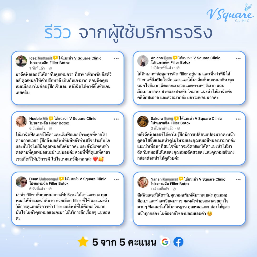 รีวิวฉีดฟิลเลอร์ใต้ตา