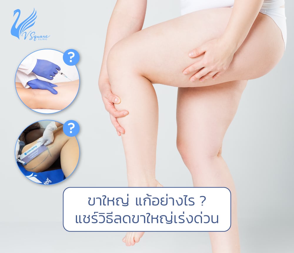 ขาใหญ่ เกิดจากอะไร ? ลดไขมันต้นขาอย่างไร ให้ปลอดภัยและเห็นผลเร็ว