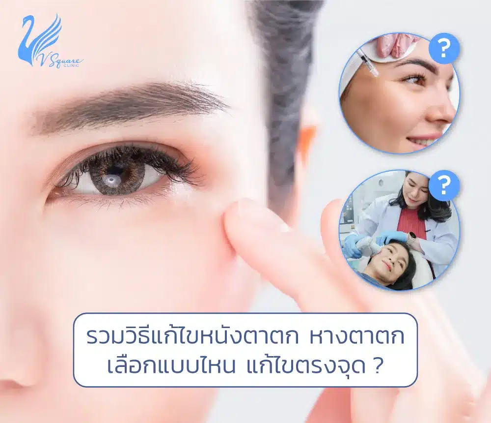 หนังตาตก หางตาตก เกิดจากสาเหตุใด รักษาอย่างไรได้บ้าง