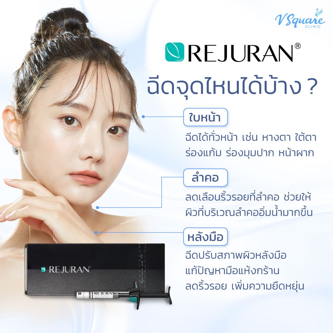 Rejuran ฉีดตำแหน่งไหนได้บ้าง