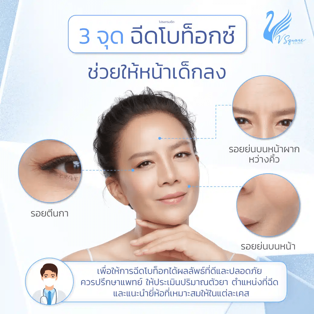 botox injection คุณต่าย