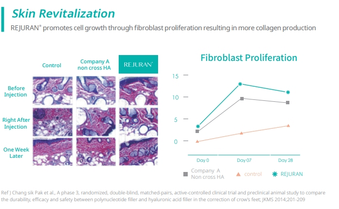 กระบวนการทำงานของ Rejuran