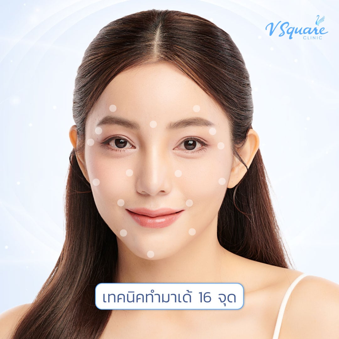 มาเด้ 16 จุด