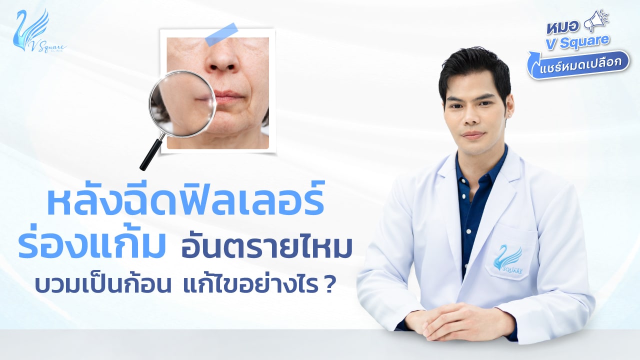 หมอให้ความรู้VSQแชร์ หมอรวี