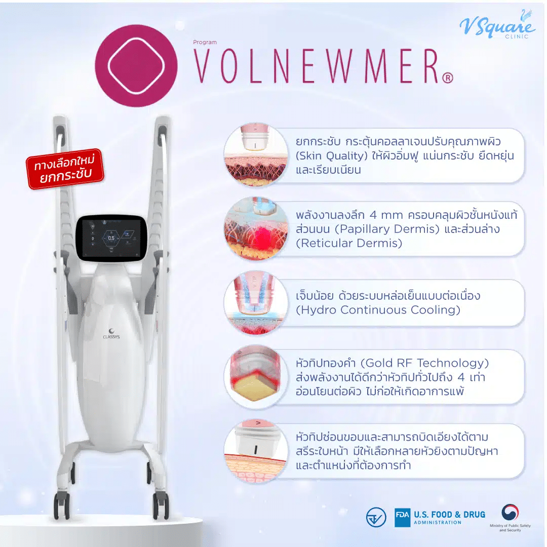 Volnewmer ยกกระชับใบหน้า