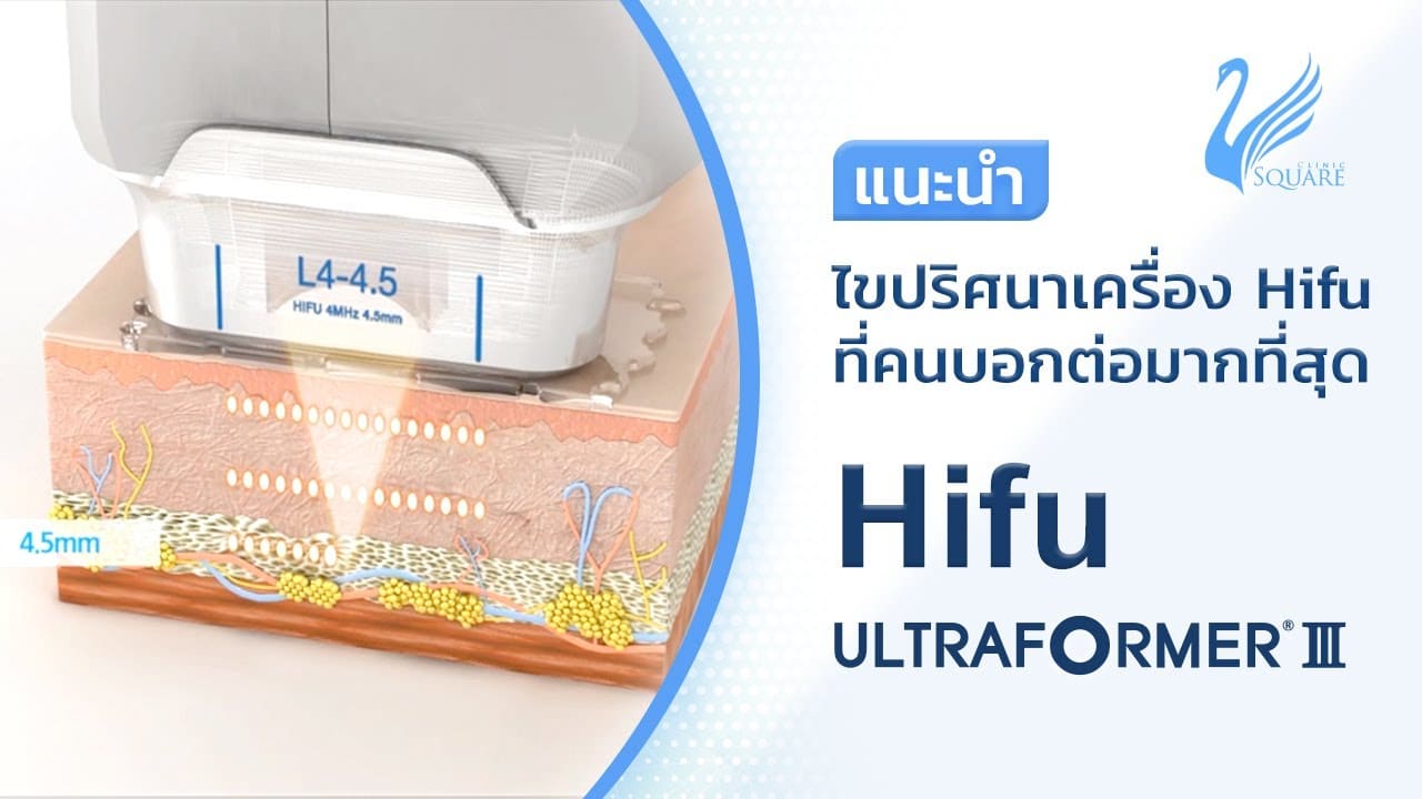 Hifu คืออะไร? ทำไม? Hifu Ultraformer III ยิ่งทำต่อเนื่องยิ่งได้ผลลัพธ์ที่ดีขึ้น