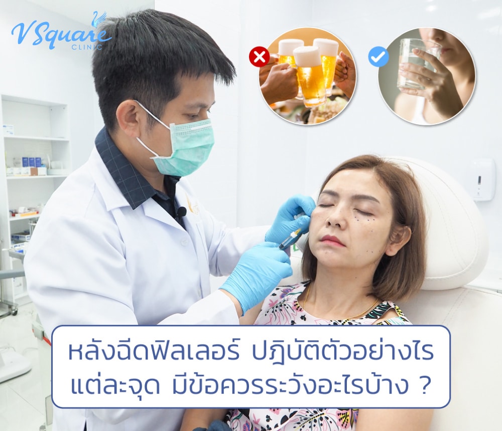ข้อปฏิบัติหลังฉีดฟิลเลอร์