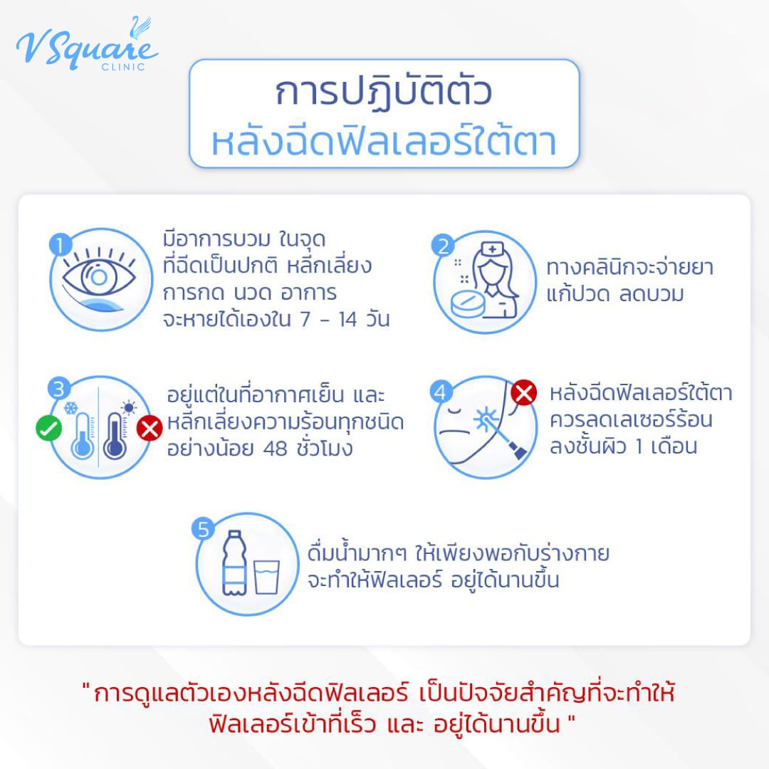 ข้อปฏิบัติหลังฉีดฟิลเลอร์ตา