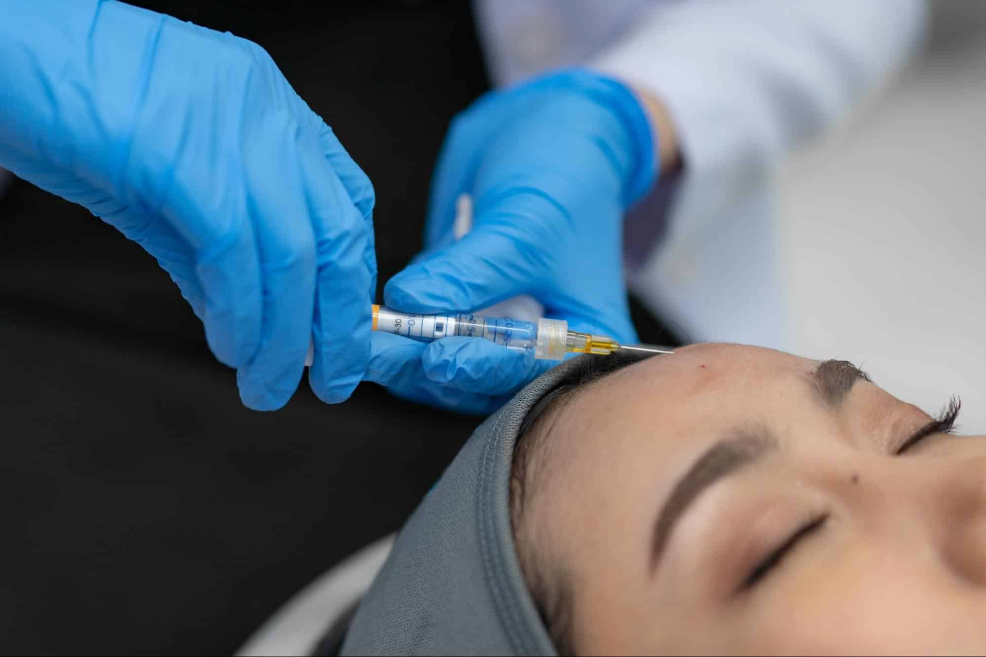 หมอฉีดฟิลเลอร์หน้าผาก_คุณอาชิ