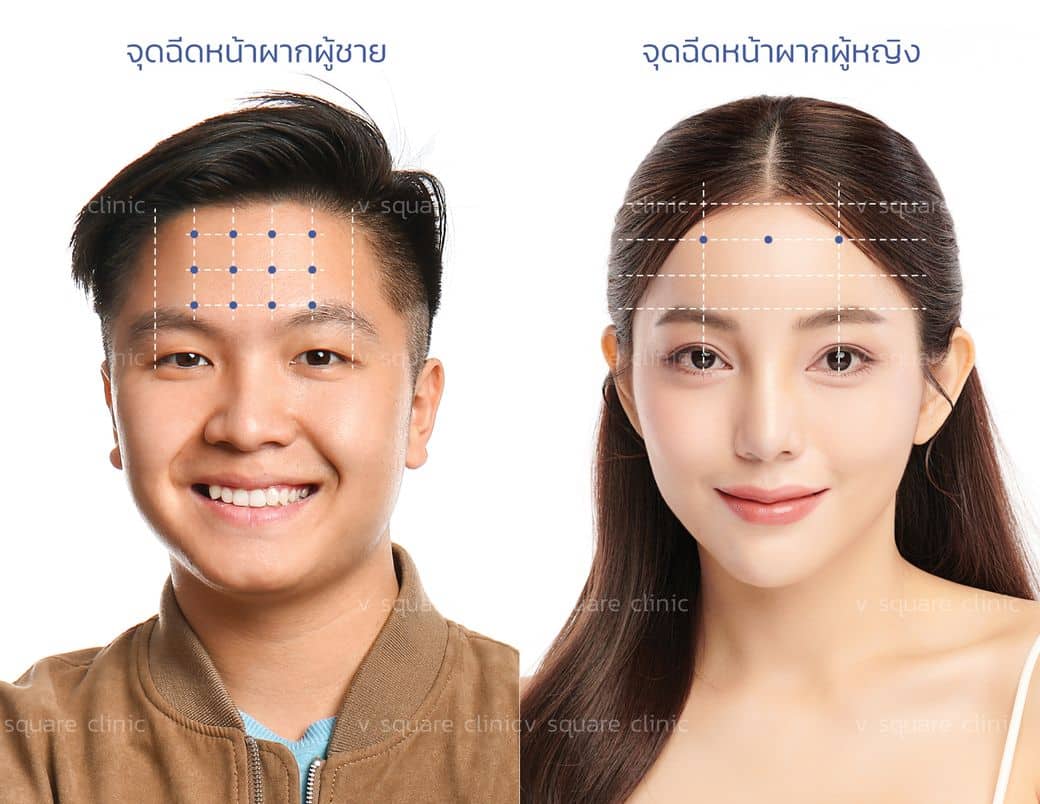 เช็กโหงวเฮ้งหน้าผาก แบบไหนดี มีวาสนา อยากปรับแก้ทำวิธีไหนได้บ้าง ? เช็กโหงวเฮ้งหน้าผาก แบบไหนดี มีวาสนา อยากปรับแก้ทำวิธีไหนได้บ้าง ?
