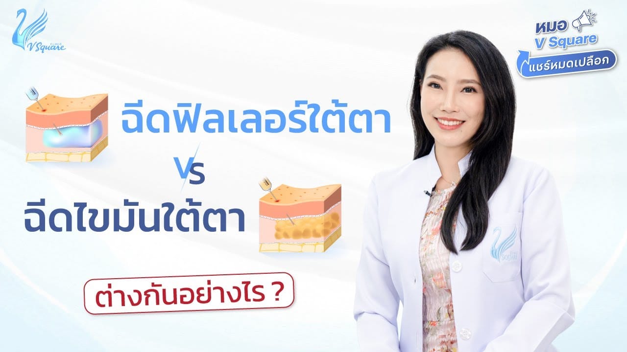 thumbnail-ฉีดฟิลเลอร์ใต้ตา-VS-ฉีดไขมันใต้ตา