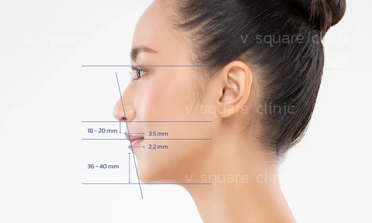 สัดส่วนใบหน้าที่เหมาะสม