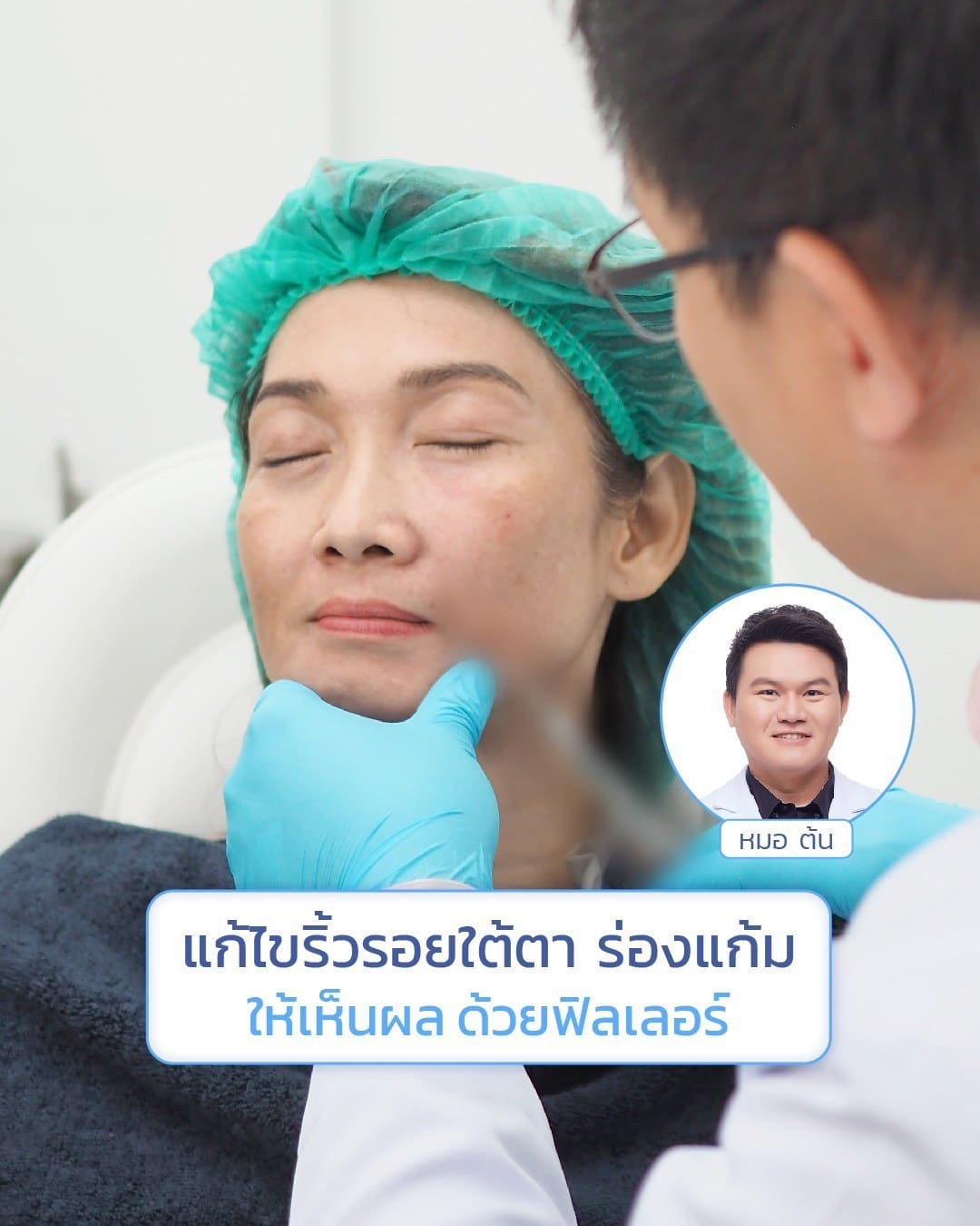 หมอต้นรีวิว-ฟิลเลอร์ใต้ตา