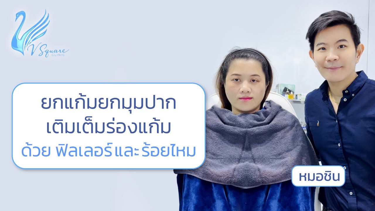 รีวิวฉีดฟิลเลอร์ยกมุมปาก by หมอชิน