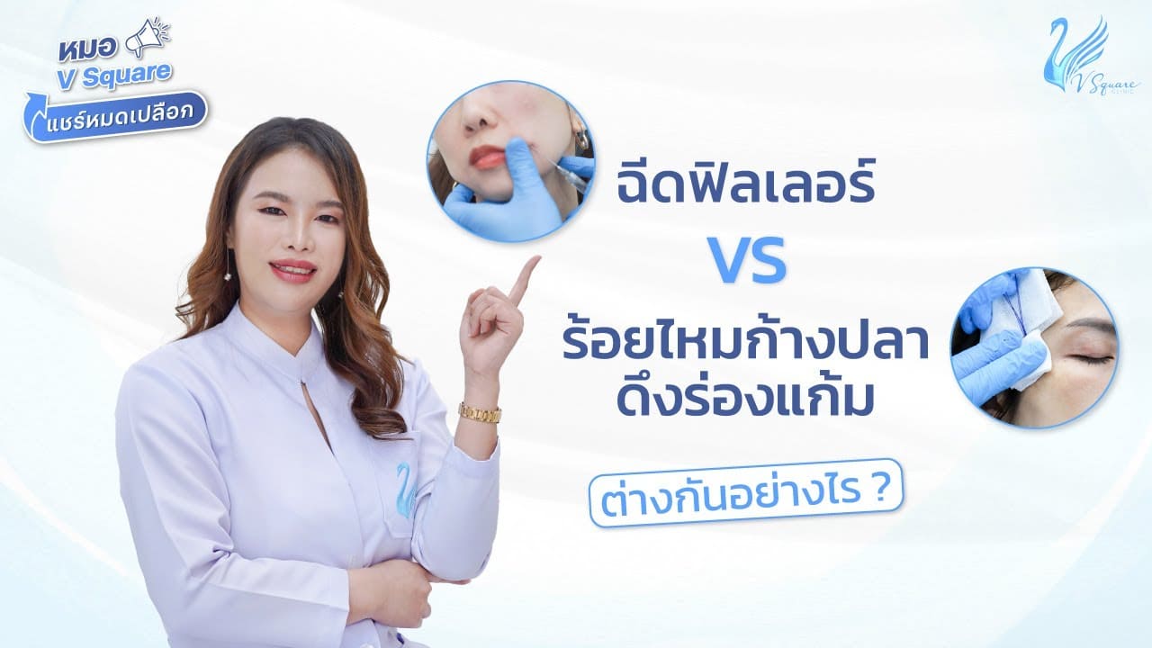 ฟิลเลอร์ร่องแก้ม กับ ร้อยไหมก้างปลาดึงร่องแก้ม ต่างกันอย่างไร?