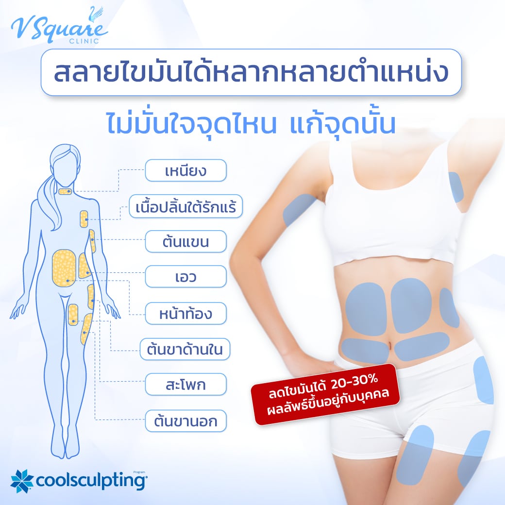 จุดทำ coolsculpting elite