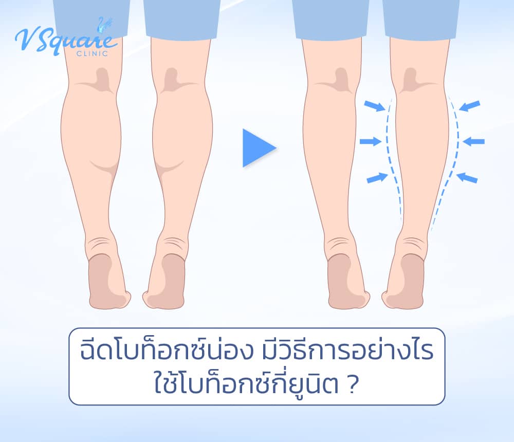ฉีดโบท็อกลดน่อง