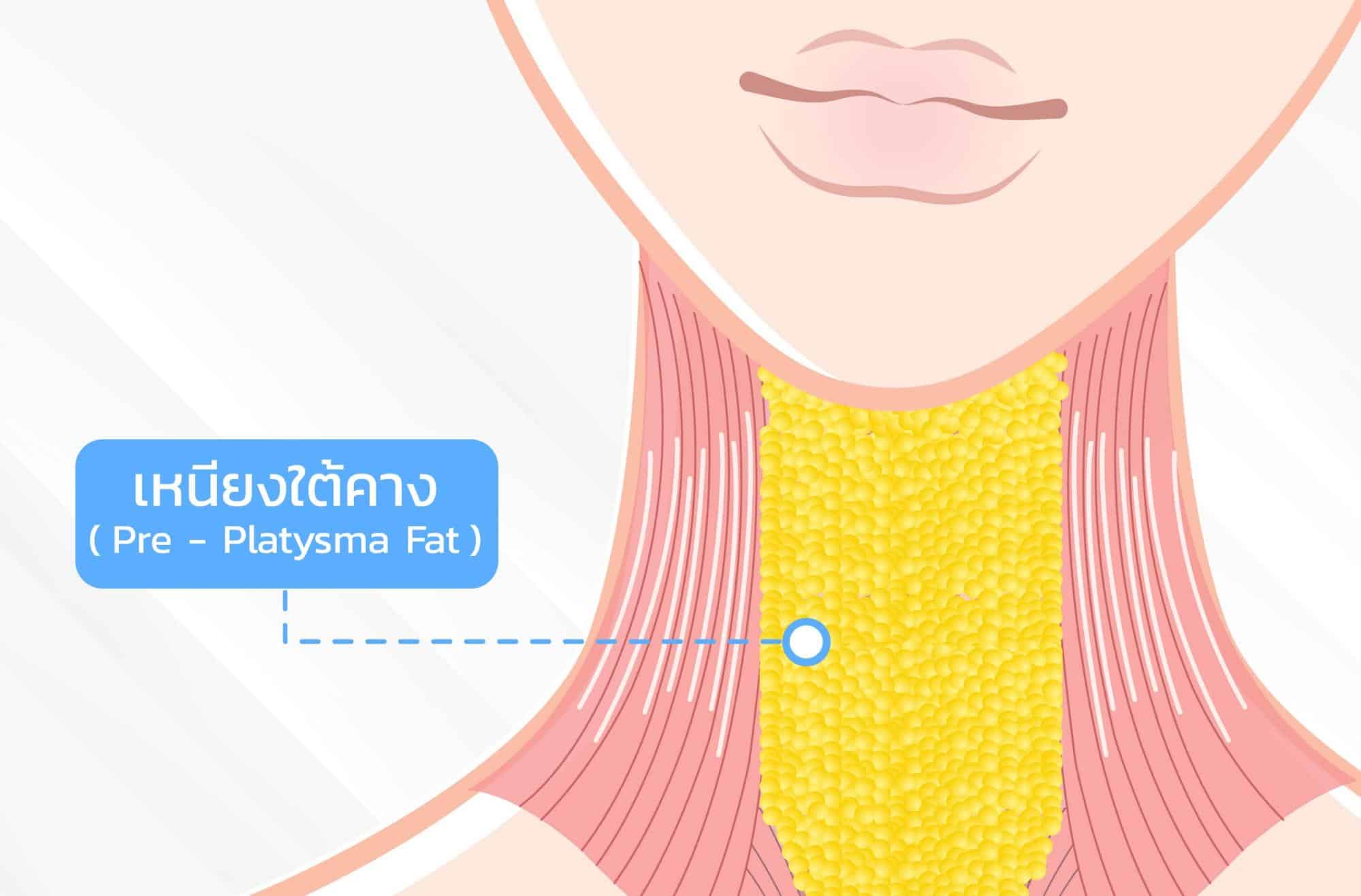 ฉีดเมโสแฟตเหนียงฉีดเมโสแฟตเหนียง