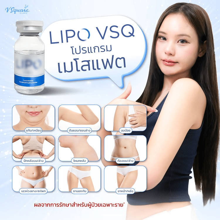 ตำแหน่งฉีดเมโสแฟต