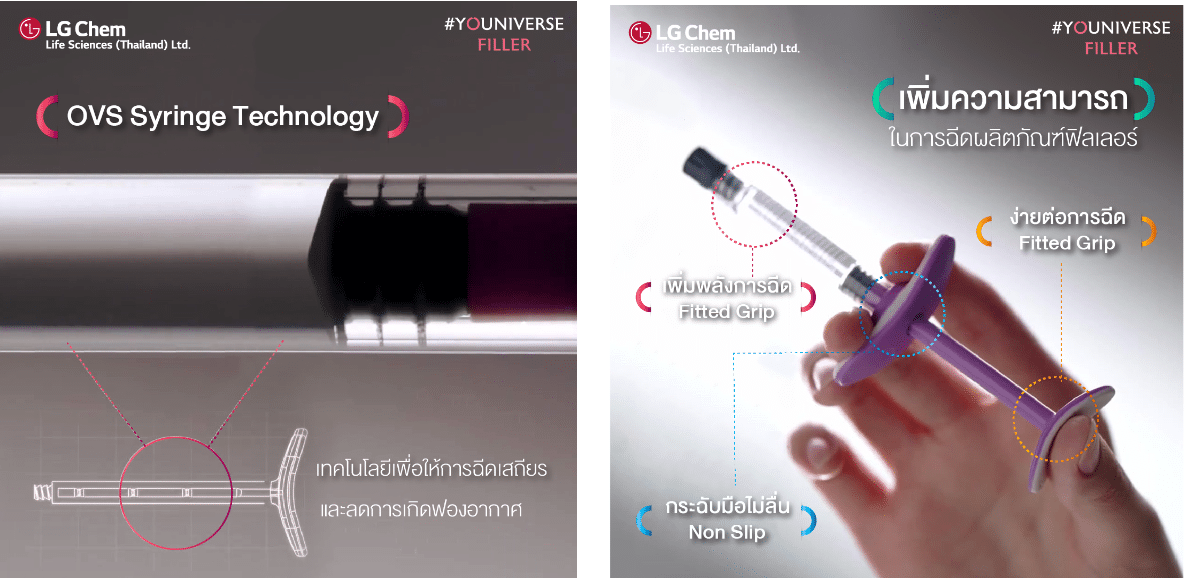 OVS-Syringe-Technology-จุดเด่นของไซริงค์ของฟิลเลอร์ Yvoire