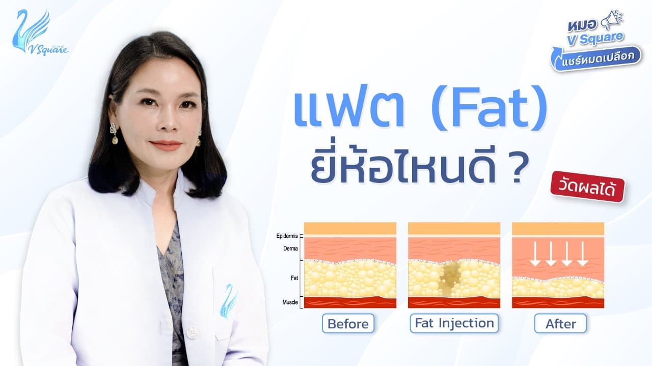 แฟต (Fat) ยี่ห้อไหนดี by หมอปุ๋ย