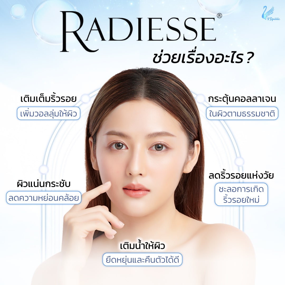 Radiesse filler ช่วยอะไรบ้าง