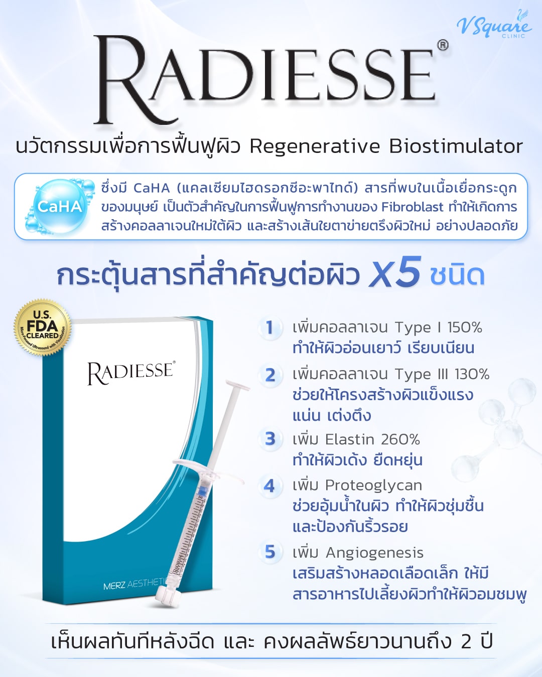 Radiesse filler คืออะไร